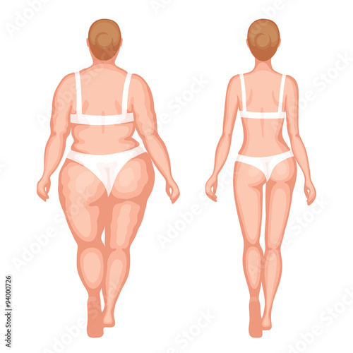 Thick woman and slender woman