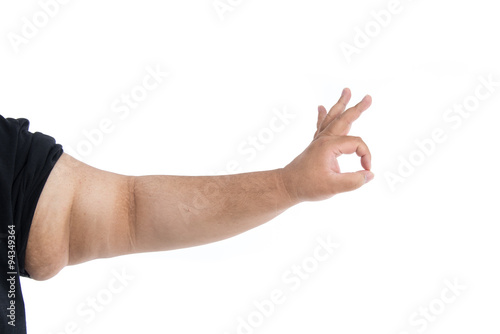 Fotografie Arm with overweight