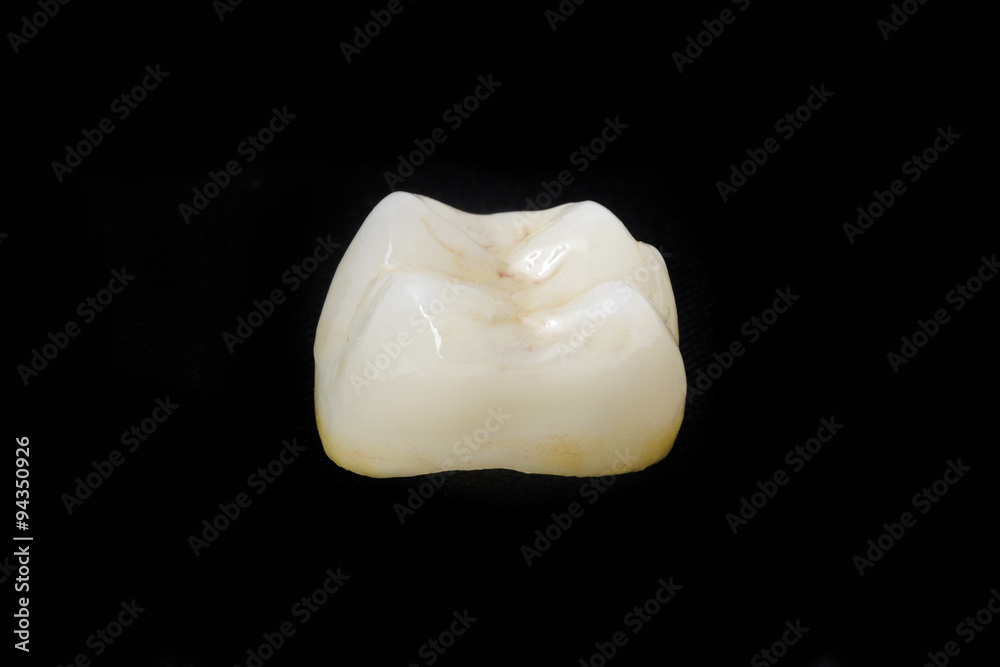 ceramic crown in dental laboratory ceramic crown in dental laboratory