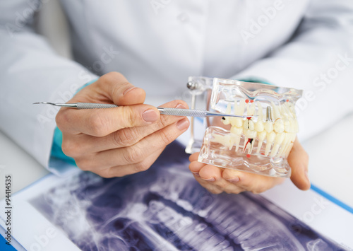  Woman practitioner studying dental model and teeth x-ray. Close-up of female dentist's hands with tools. 
