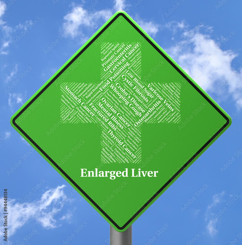 Enlarged Liver Represents Ill Health And Affliction Stock Illustration