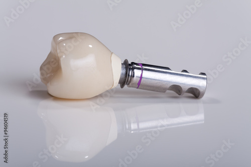 Zahn Implantat Nahaufnahme photo