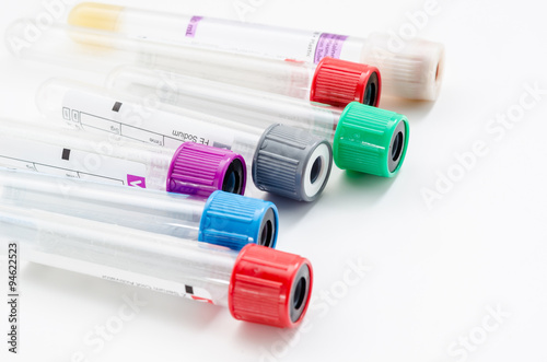 фотографія vacuum tubes for collecting blood samples in the lab.