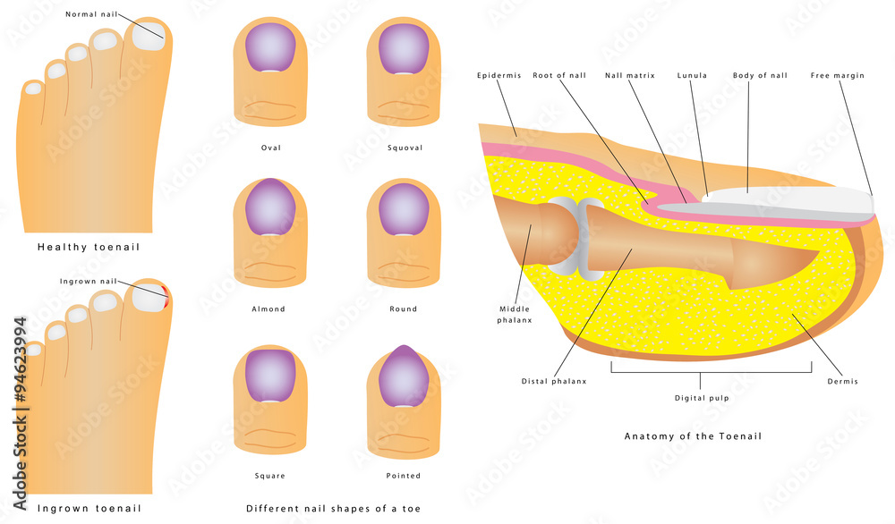 Anatomy Of The Toenail Stock Vector Adobe Stock