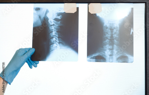 nurse and x-ray