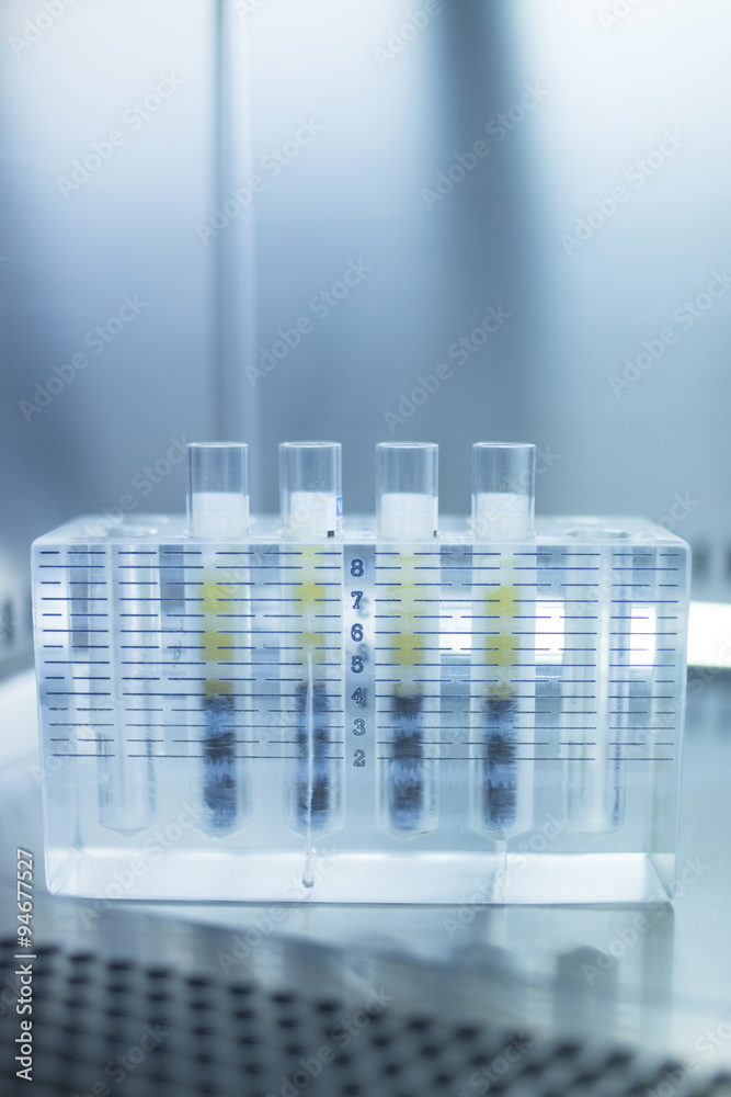 Medical laboratory test tubes PRP platelet rich plasma