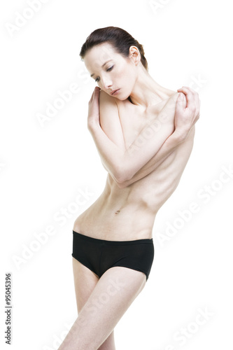 Young woman suffering from anorexia photo