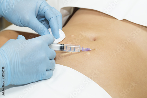 woman is in the process cellulite mesotherapy clinic photo