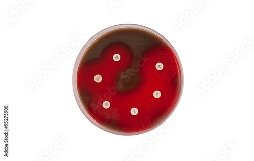 Antibiogram showing sensibility to Streptococcus pneumoniae bacteria on petri dish photo