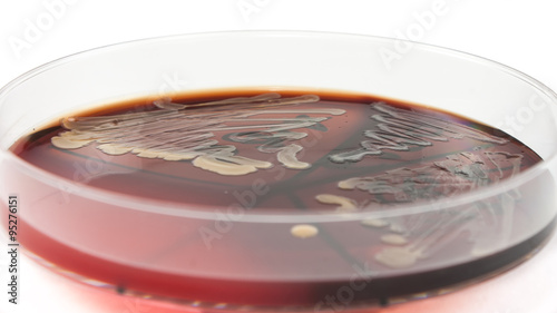 Petri dish with Enterococcus faecalis bacteria photo