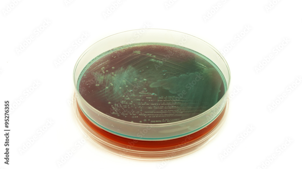 Pseudomonas aeruginosa bacteria on Cled agar petri dish isolated on white  background, cysteine lactose electrolyte deficient Stock Photo | Adobe Stock