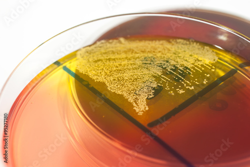 Petri dish showing infection with Staphylococcus aureus bacteria