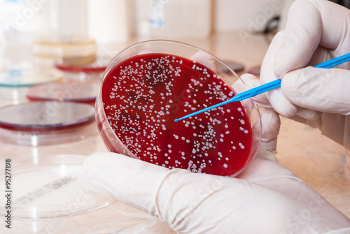 Fényképezés Laboratory doctor hands with sterile gloves holding inoculation loop on blood agar infected with Staphylococcus