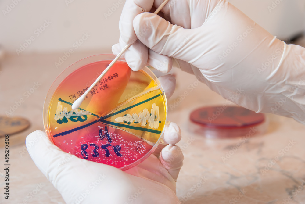 Sterile swab and Staphylococcus aureus bacteria on petri dish