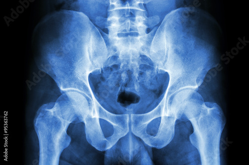 human's pelvis and hip joints