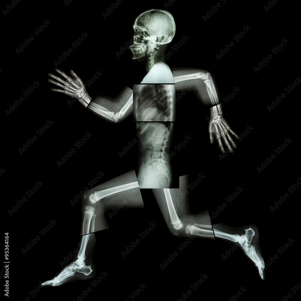 Aerobic Exercise (human bone is running) ,(Whole body x-ray : head ,neck ,shoulder ,shoulder ,arm ,elbow ,forearm ,hand ,finger ,joint ,thorax ,abdomen ,back,pelvis ,hip ,thigh ,leg ,knee ,foot ,heel) Aerobic Exercise (human bone is running) ,(Whole body x-ray : head ,neck ,shoulder ,shoulder ,arm ,elbow ,forearm ,hand ,finger ,joint ,thorax ,abdomen ,back,pelvis ,hip ,thigh ,leg ,knee ,foot ,heel)