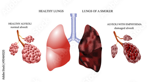 the dangers of Smoking