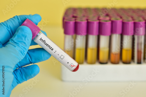 Influenza positive blood sample photo