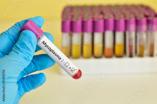 Mycoplasma positive blood sample photo