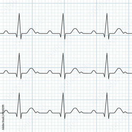 Vector cardiogram,flat design