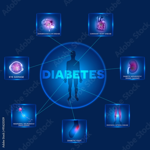 Diabetes affected organs