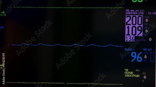 Screen of multiparameter ambulance patient monitor in Russian testing temperature, blood pressure, heart rate and oxygen level closeup photo