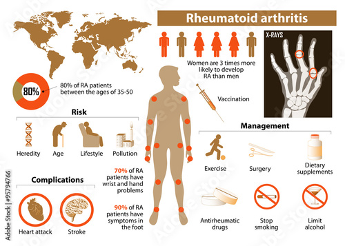 Rheumatoid arthritis photo