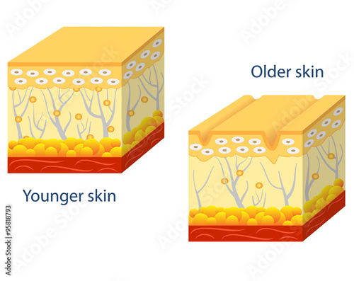 Younger skin and aging skin.