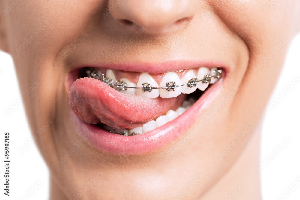 Fototapeta premium Uśmiechnięte usta językiem i szelkami