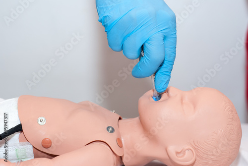 laryngeal mask child