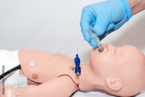 laryngeal mask child