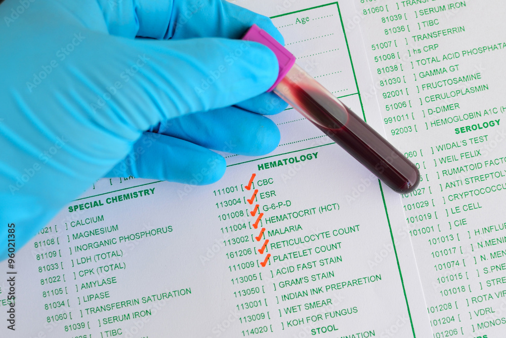 Blood sample for hematology testing Stock Photo | Adobe Stock