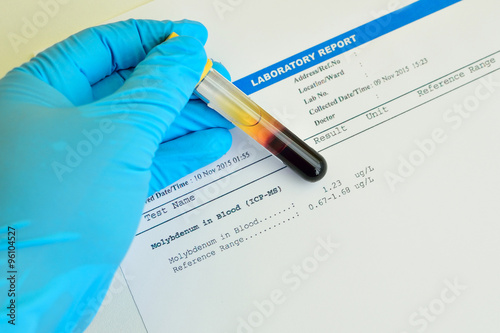 фотографія Blood sample with molybdenum testing result