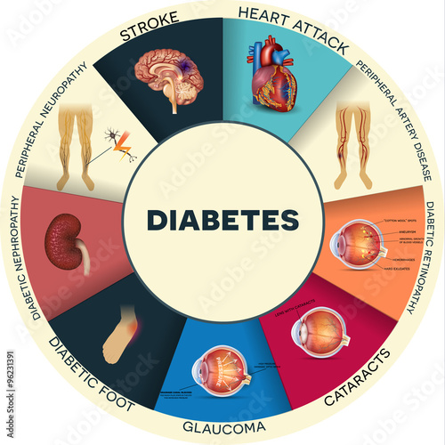 Diabetes complications round info graphic