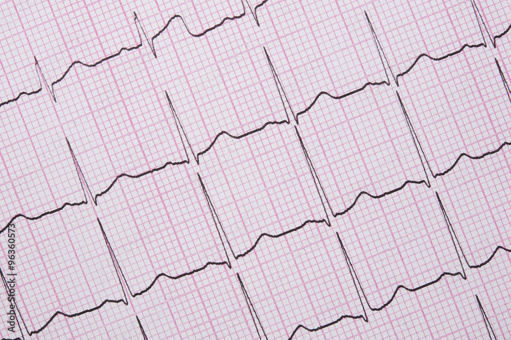 Close up of a Electrocardiograph also known as a EKG Close up of a Electrocardiograph also known as a EKG