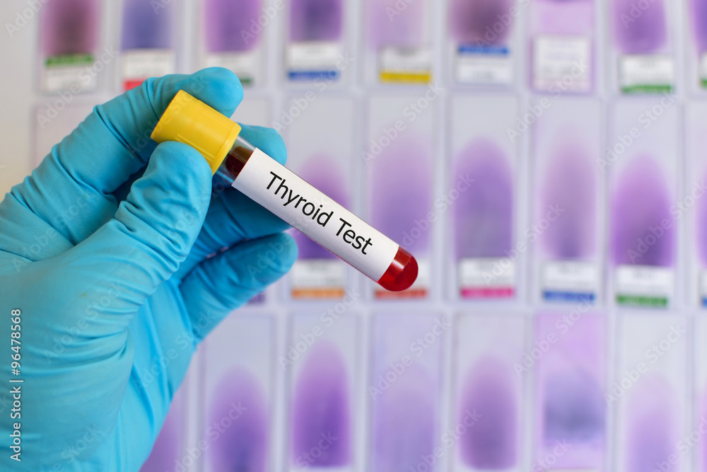 Blood for thyroid function test Blood for thyroid function test