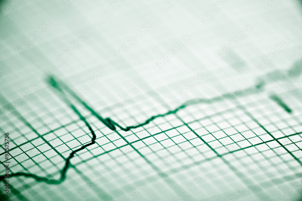 Electrocardiogram Electrocardiogram