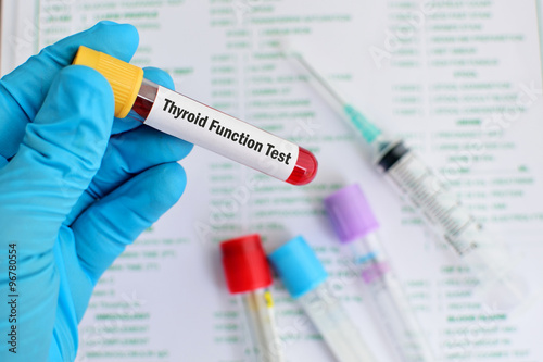 Blood sample for thyroid function test photo