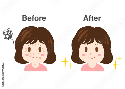 シワに悩む女性のイラスト: ビフォーアフター