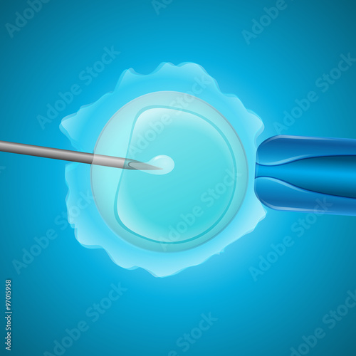in vitro fertilization