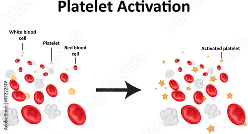Platelet Activation