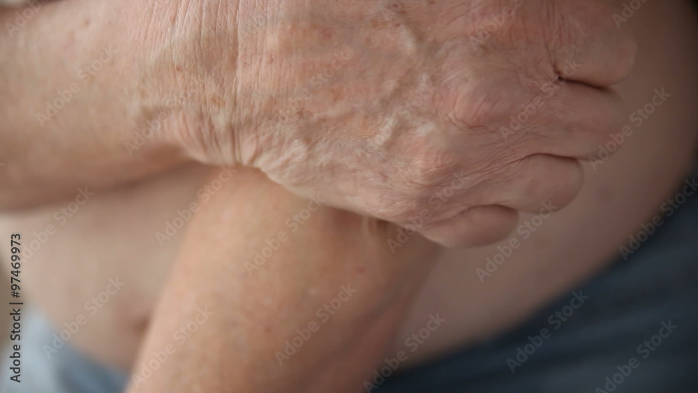 man with an itch on and around his elbow