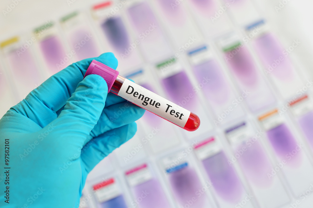 Blood for dengue virus test Blood for dengue virus test