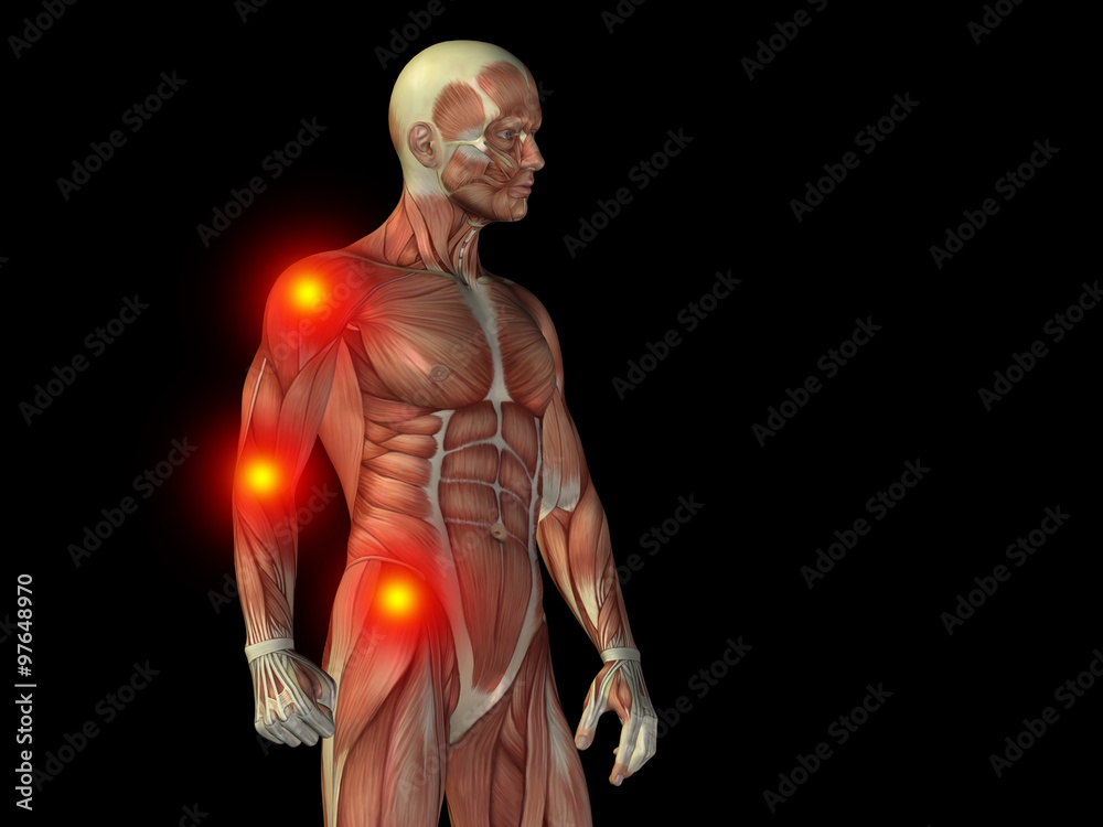 Conceptual human body anatomy pain on black