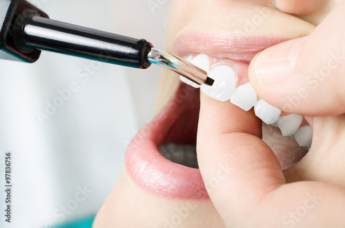 Examine the teeth vitality. Close up