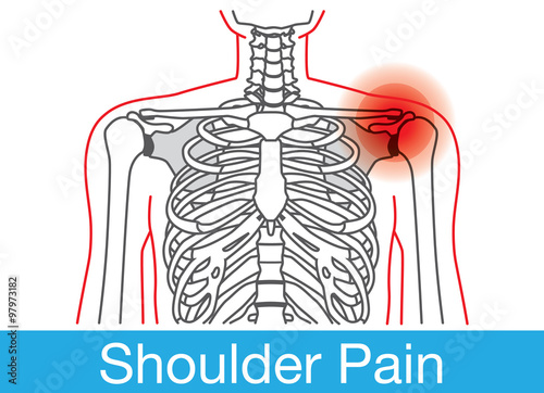 Outline of Body and bone which have shoulder pain from lifestyle. This is medical illustration