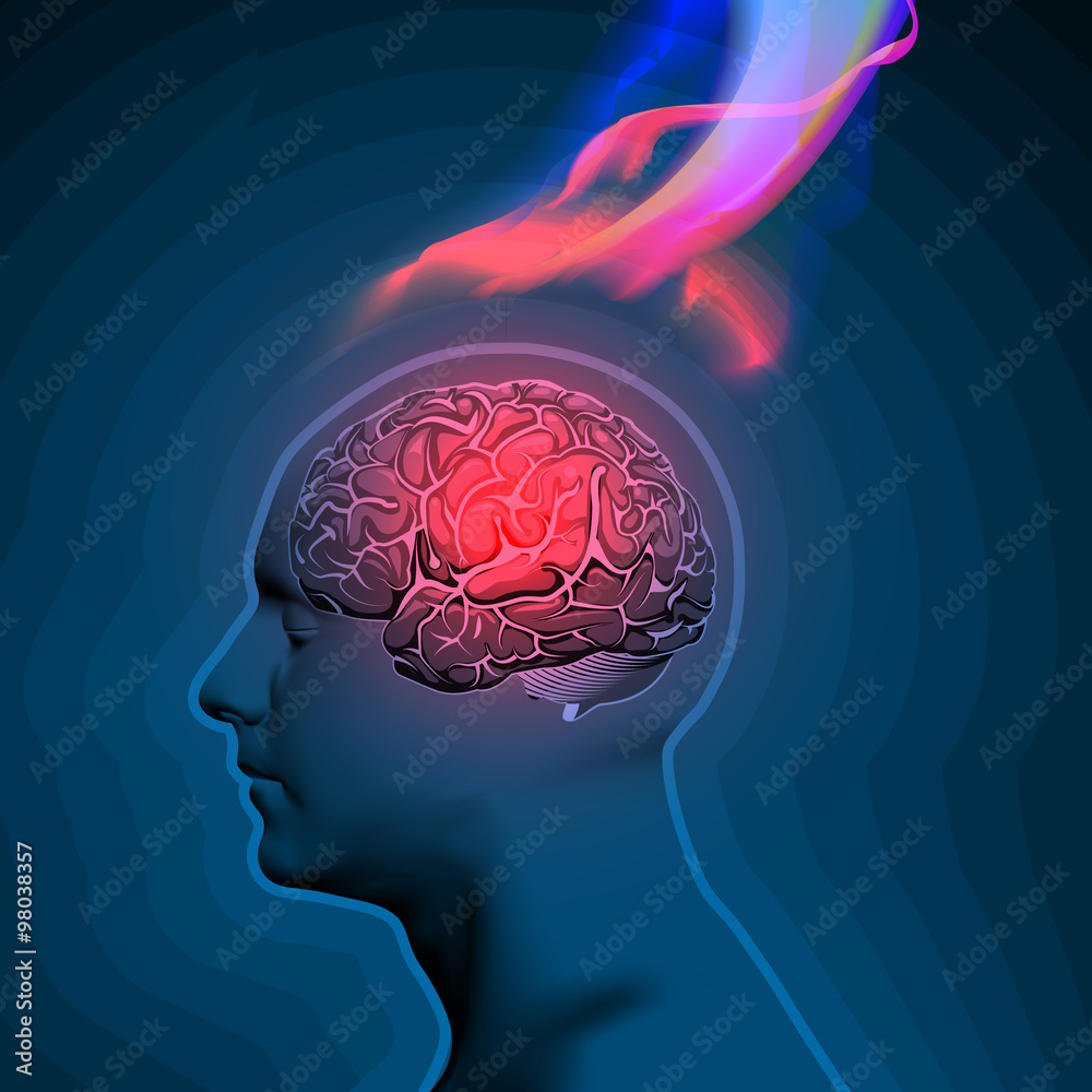 Vector Illustration of Headache with Flames Vector Illustration of Headache with Flames