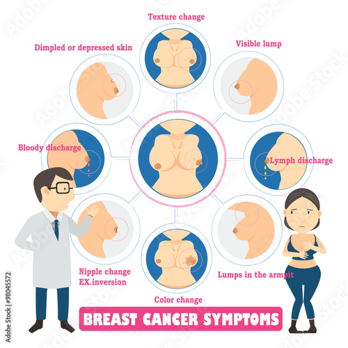 Breast cancer symptoms in circles,info graphic vector illustration.