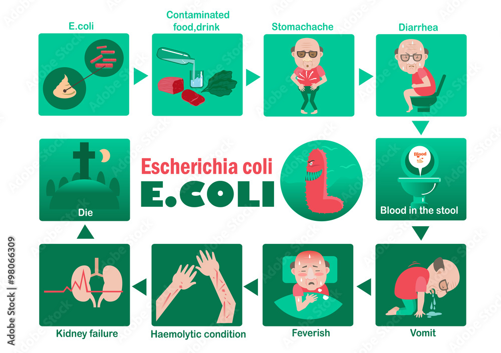 E Coli Symptoms