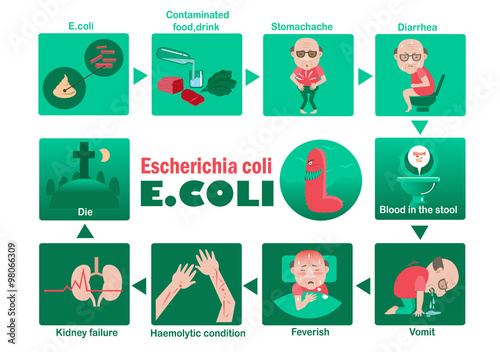 E. coli symptom of Patients Escherichia coli Info Graphic.vector illustration.